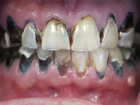 Danny Shiri DDS Danny Shiri DDS